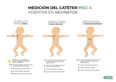 Medición del catéter PICC a insertar en Neonatos