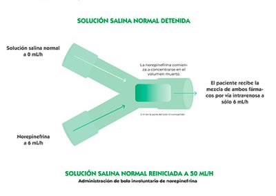 Repercusión volumen muerto en la dinámica de fluidos