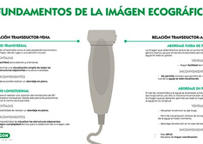 Fundamentos imagen ecográfica