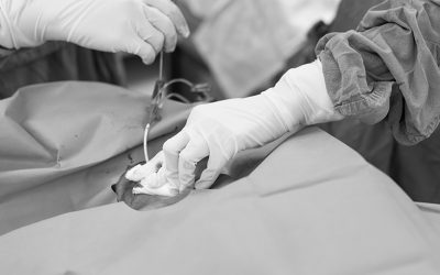 9 Beneficios en la canalización venosa central guiada por ECG