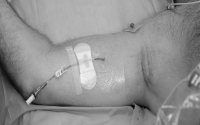 3 complicaciones a tener en cuenta para mantener un picc permeable