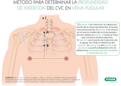 Método para determinar la profundidad de inserción del CVC en vena yugular