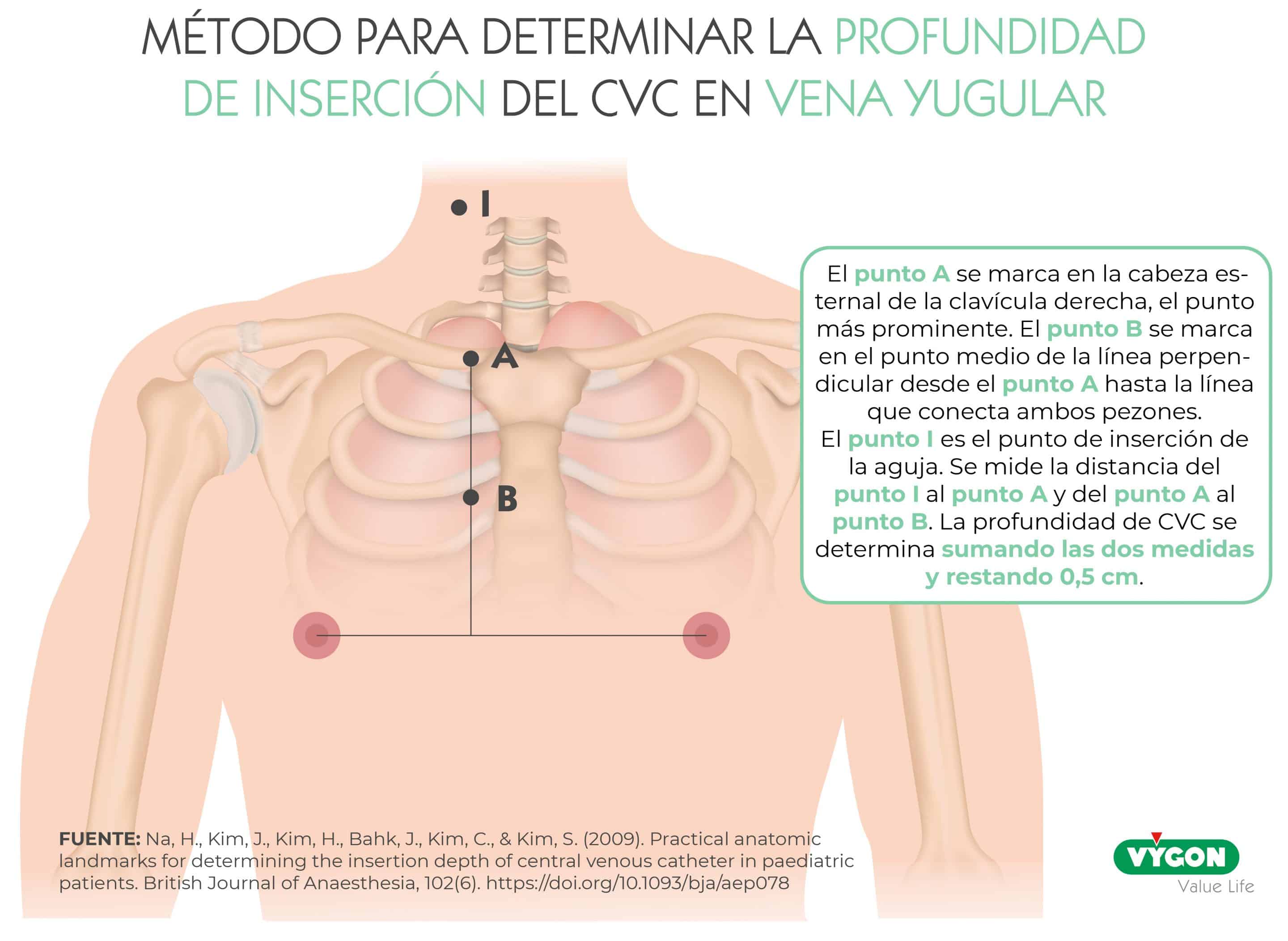 Método para determinar la profundidad de inserción del CVC en vena yugular