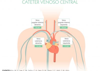 Puntos de inserción del CVC