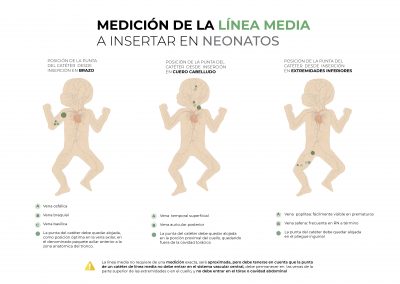 Medición de la Línea Media a insertar en Neonatos