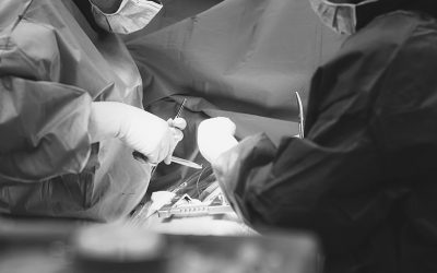 ¿Qué importancia tiene la exactitud y la precisión en los métodos de monitorización hemodinámica?