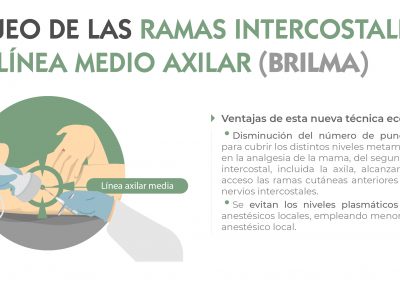 Ventajas bloqueo BRILMA