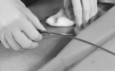 8 prácticas para reducir la infección relacionada con el catéter arterial