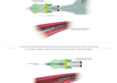 Funcionamiento válvula antirreflujo