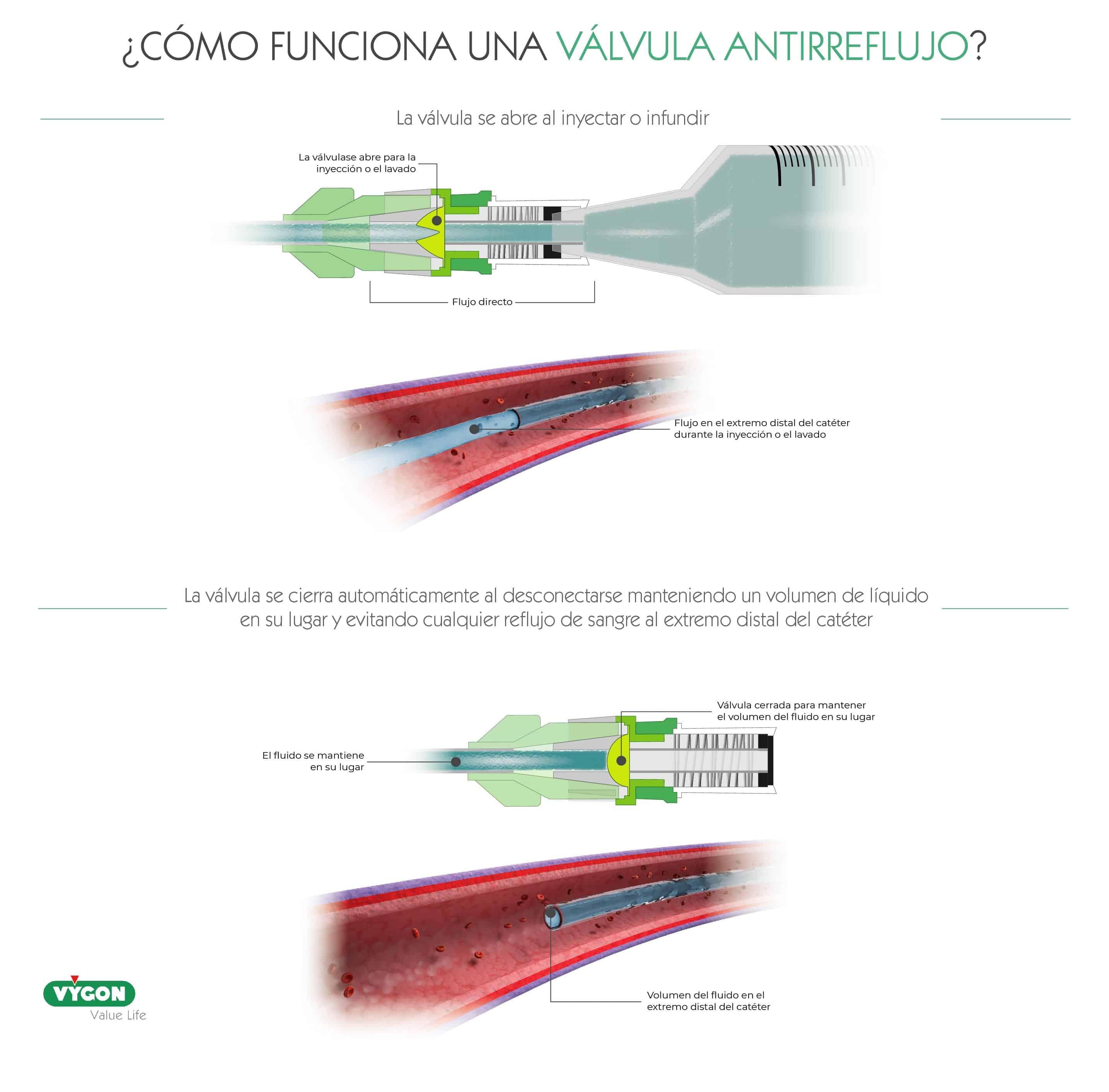 Válvula antirreflujo funcionamiento