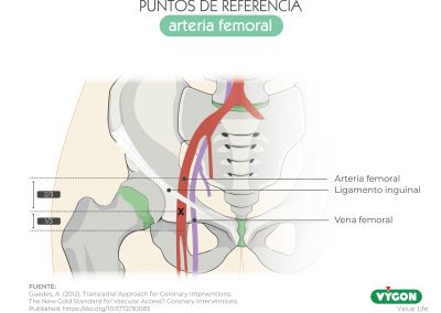 Puntos de referencia arteria femoral