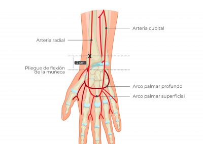 Puntos de referencia arteria radial