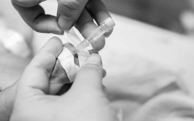 Recomendaciones en el uso de adhesivos de fijación de catéteres en neonatos