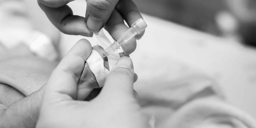 Recomendaciones en el uso de adhesivos de fijación