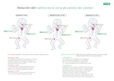 Relación del calibre de la vena vs calibre del catéter en neonatos