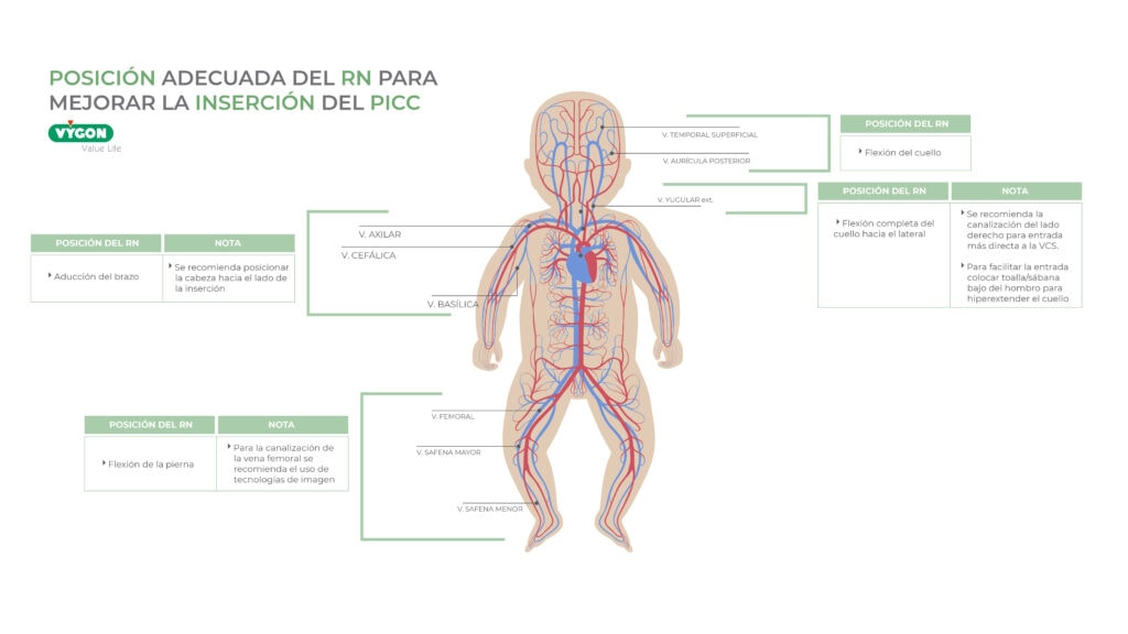 Venas disponibles en neonatos