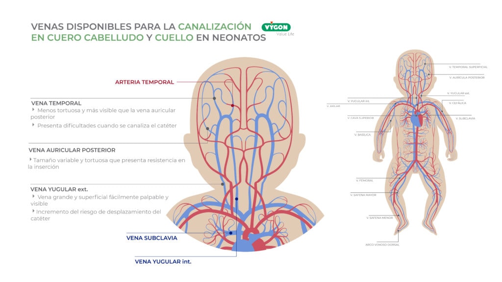 Venas disponibles para la canalización en cuero cabelludo y cuello en neonatos