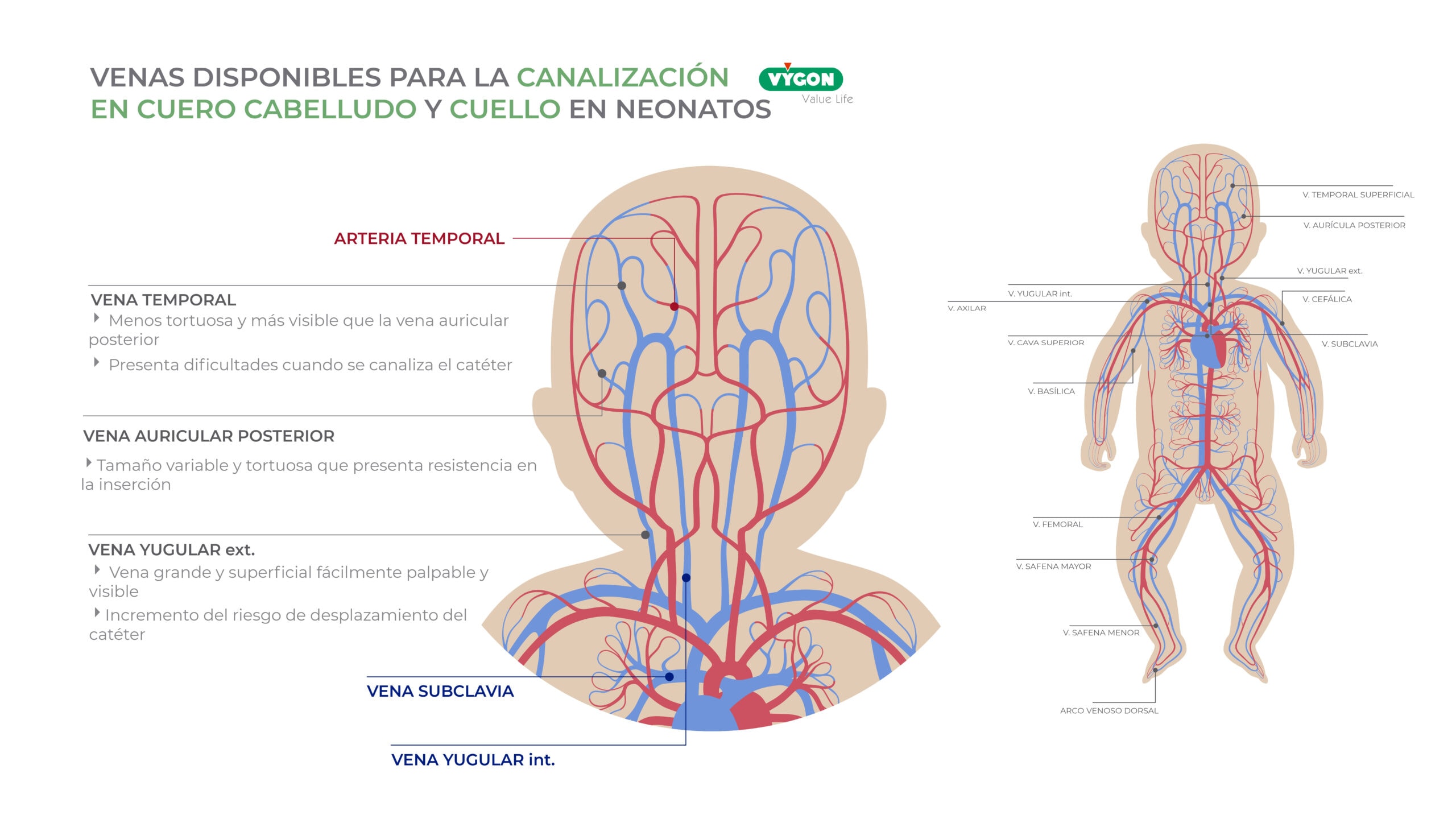 Venas disponibles para la canalización en cuero cabelludo y cuello en neonatos
