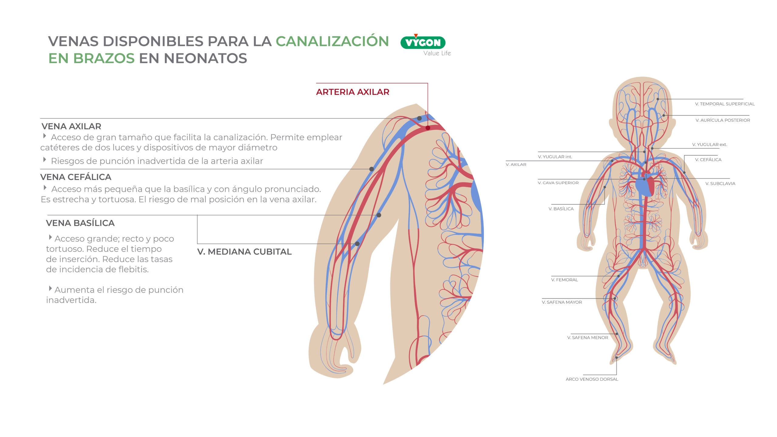 venas brazos neonatos