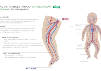Venas disponibles para la canalización en piernas en neonatos