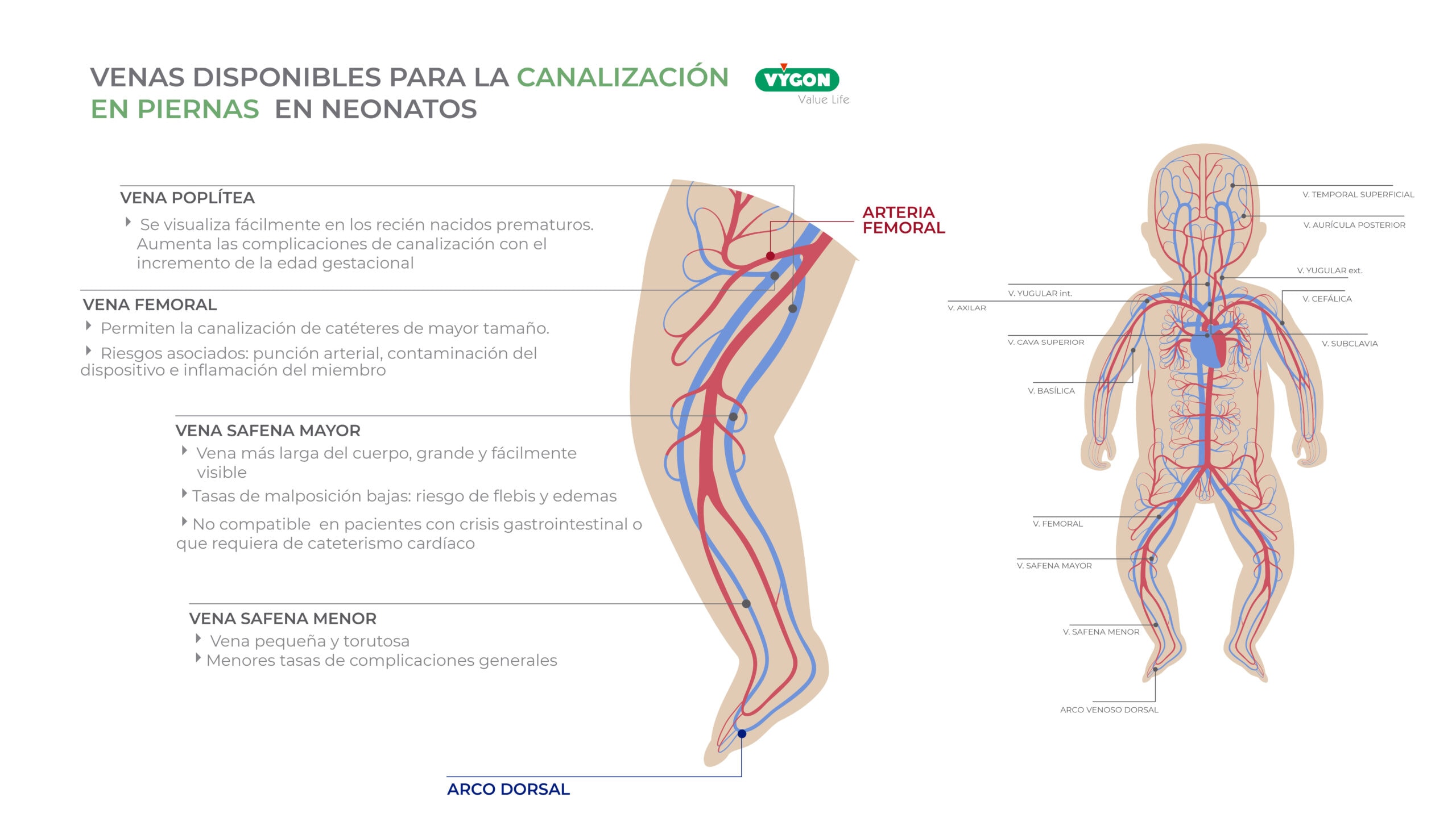 Venas piernas neonatos