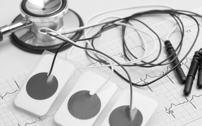 Cómo interpretar el ECG a la hora de colocar un catéter PICC