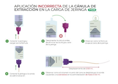 Aplicación incorrecta de la cánula de extracción en la carga de jeringa