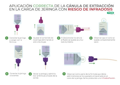 Aplicación correcta de la cánula de extracción en la carga de jeringa con riesgo de infradosis