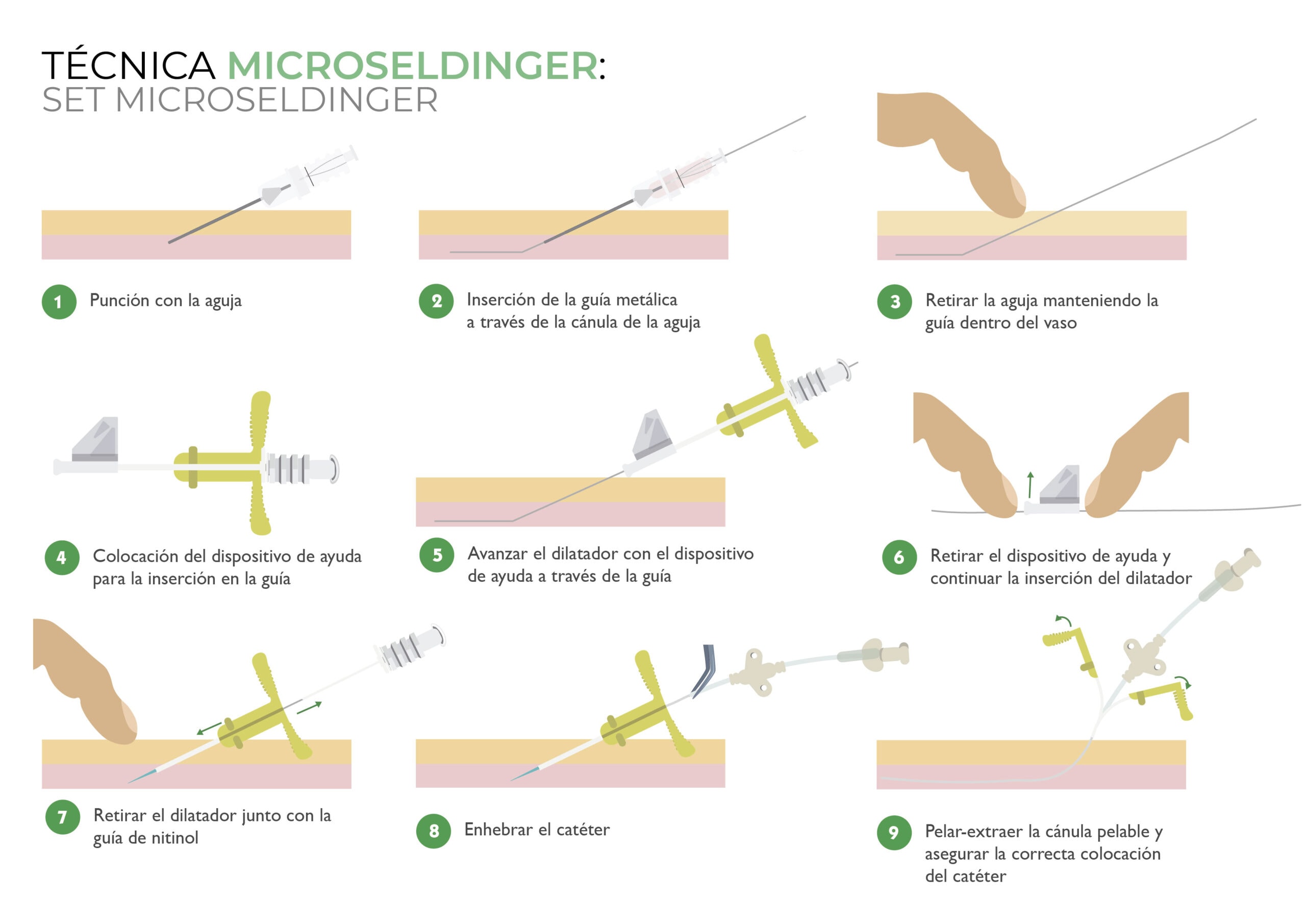 canalización picc set microseldinger