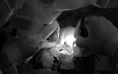 Claves para la fluidoterapia en neurocirugía