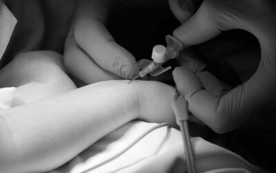 7 Claves para evitar la amortiguación en la onda de presión arterial