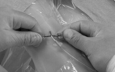 Fuga en el punto de inserción del catéter midline o PICC: ¿qué está pasando?