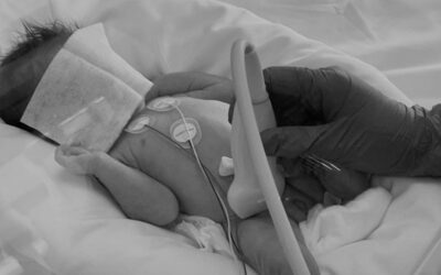 ¿Cómo diferenciar el vaso arterial del vaso venoso ecográficamente en el paciente neonatal?