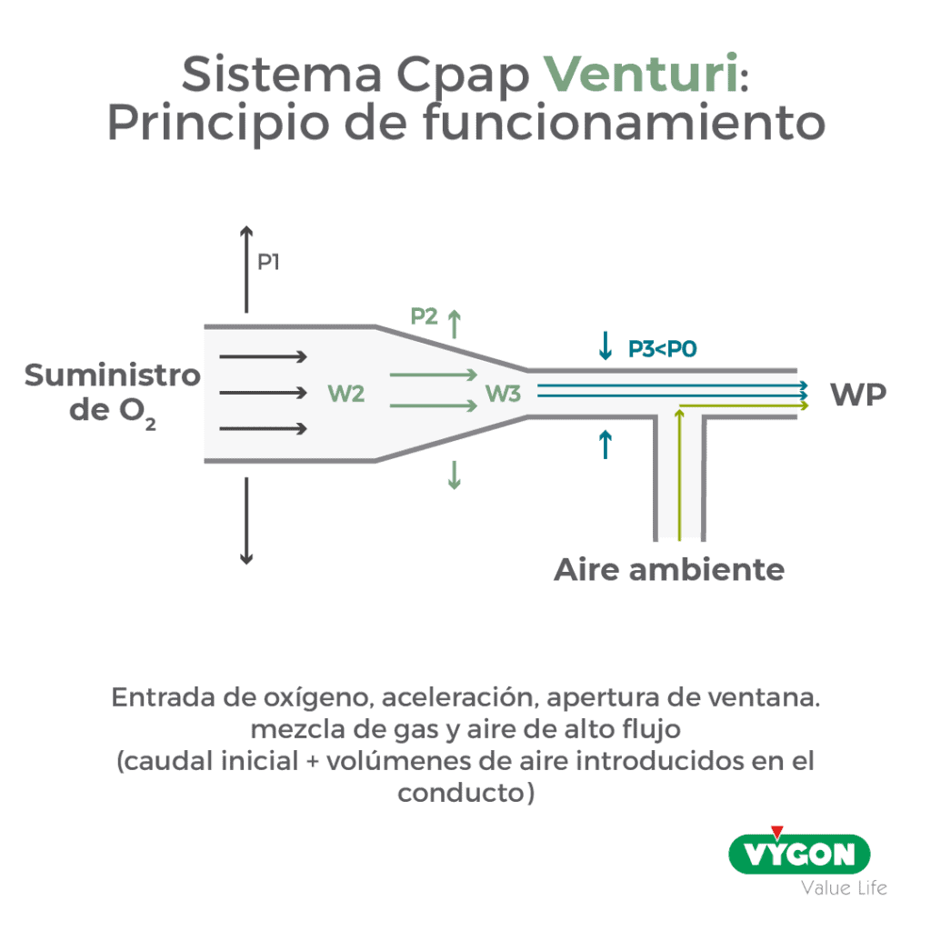 sistema cpap Venturi: principio de funcionamiento