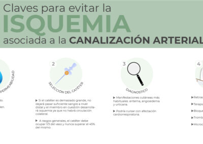 4 Claves para evitar la isquemia asociada a la canalización arterial