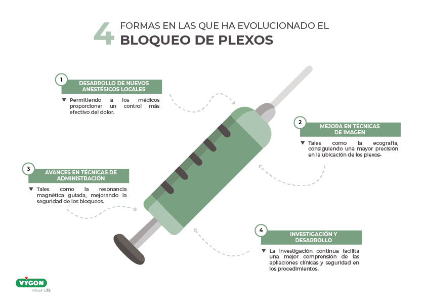 4 formas en las que ha evolucionado el bloqueo de plexos
