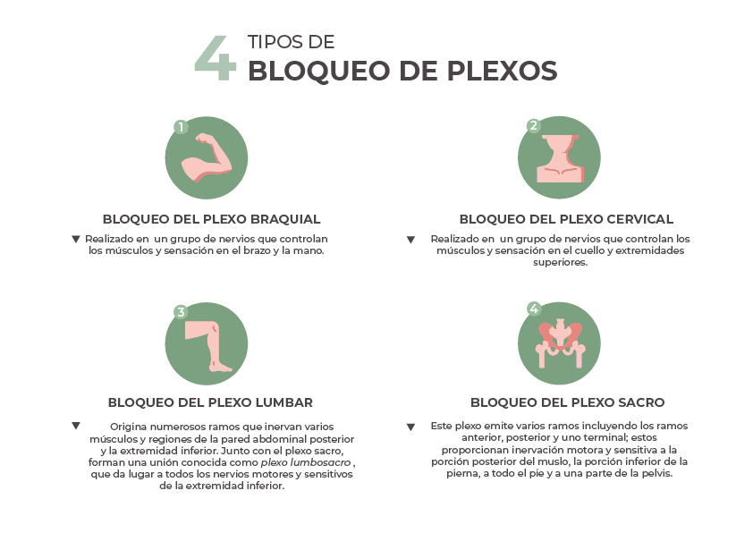 4 tipos de bloqueo de plexos