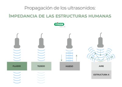 Propagación de los ultrasonidos – Impedancia de las estructuras humanas