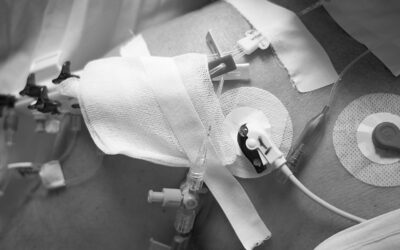 4+1 razones para no utilizar rampas con catéteres cortos