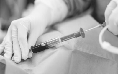 Acceso venoso femoral: ¿En qué pacientes es una opción?