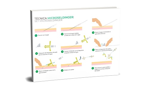 Canalización-PICC-neonatal-con-Técnica-microseldinger-set-microseldinger