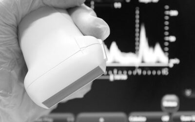 Modo Doppler en el acceso vascular: 4 cosas que debes conocer para evitar errores de interpretación