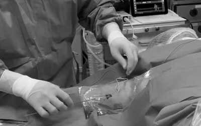 La tunelización como herramienta clave en el paciente complejo: el protocolo RAVESTO