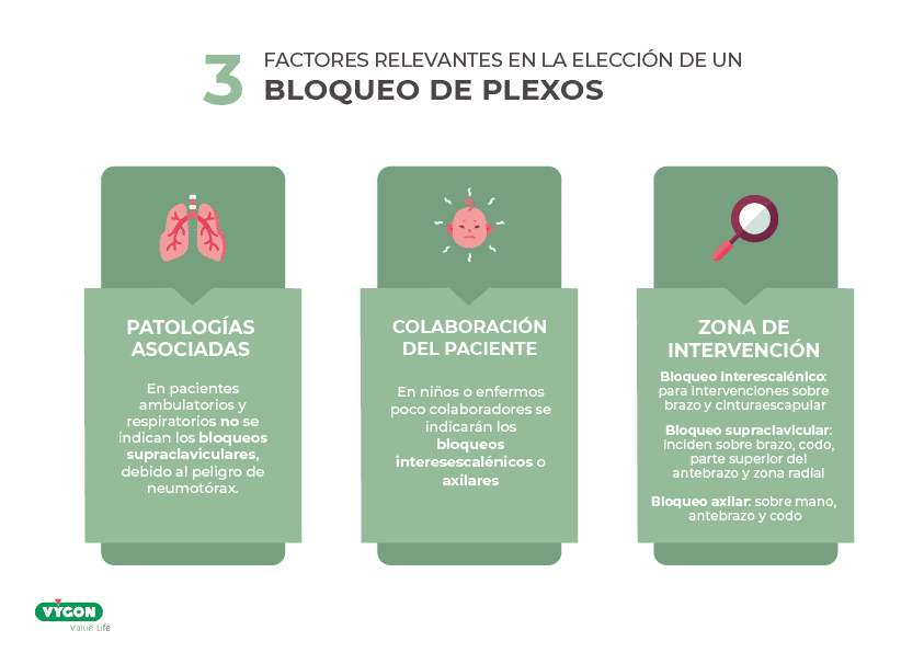 3 factores relevantes en la elección de un bloqueo de plexos