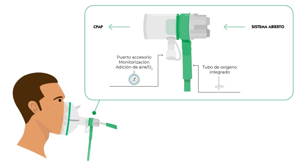 Esquema de montaje de CPAP Esquema montaje CPAP