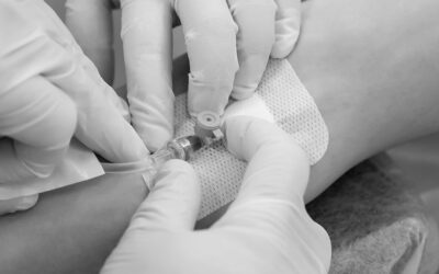 Sistemas de fijación del catéter venoso central: ¿cuál es la opción más segura?