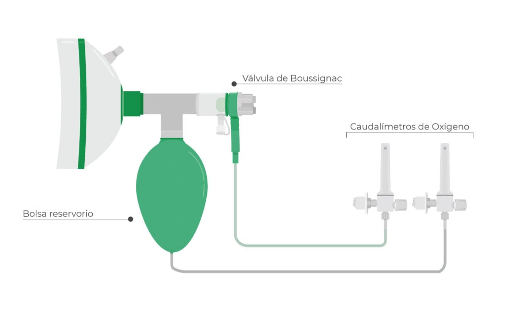 Esquema de montaje de la super Boussignac