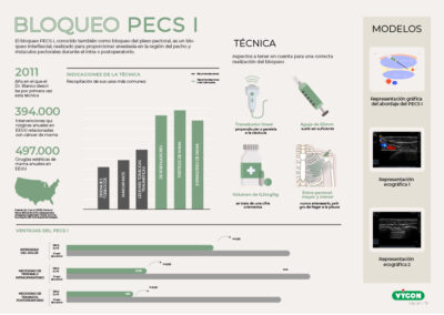 Bloqueo fascial PECS I