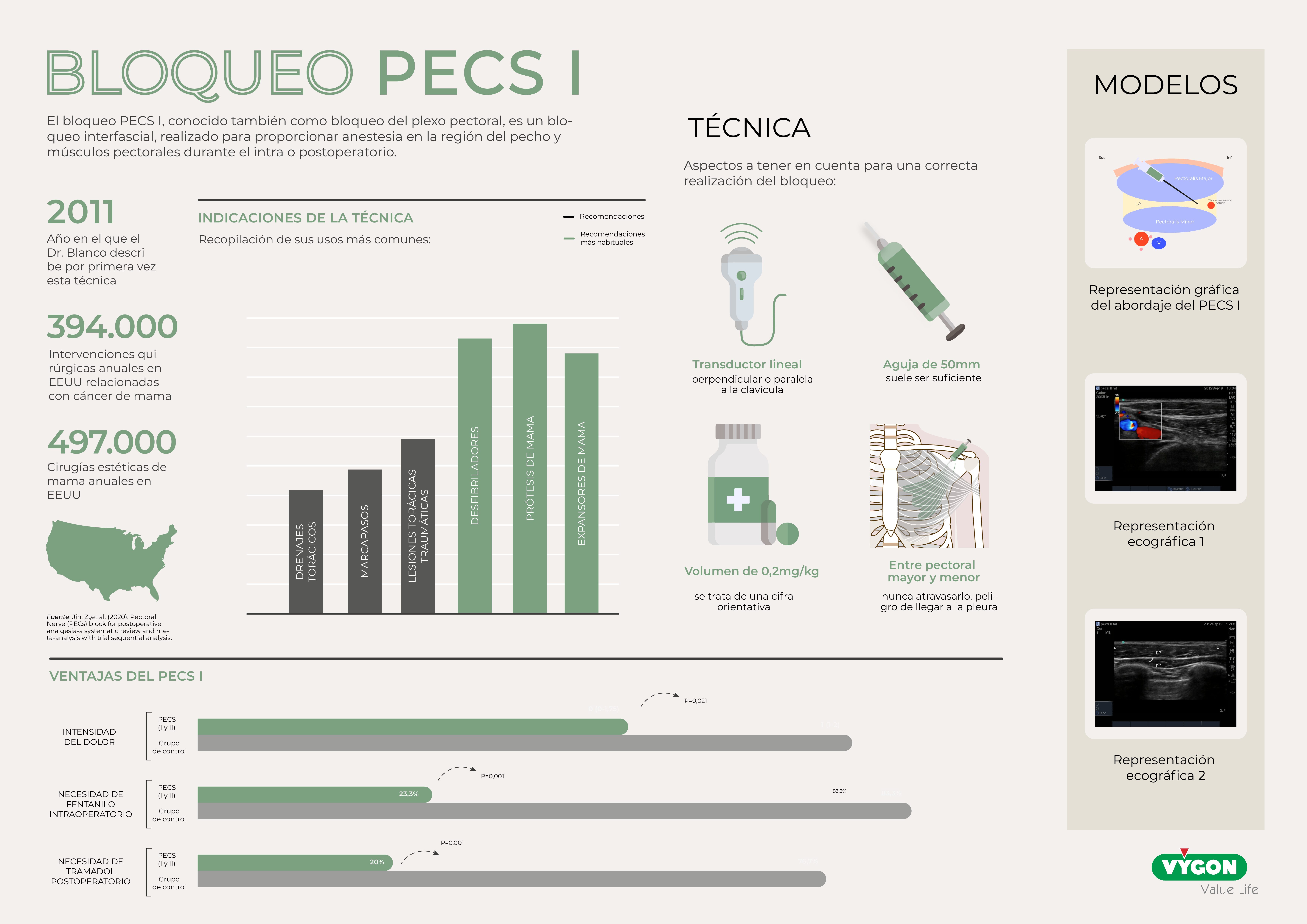 Infografía programa de trasplantes