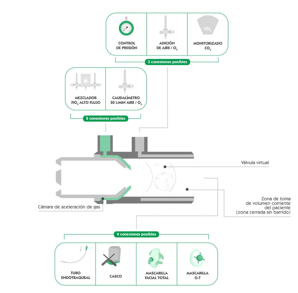 Diferentes opciones de montaje de un sistema CPAP